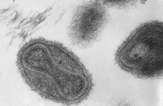 Microscopía electrónica del virus variola (imagen obtenida en 1975). Wikimedia Commosn